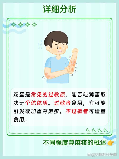 蕁麻疹能吃雞蛋嗎