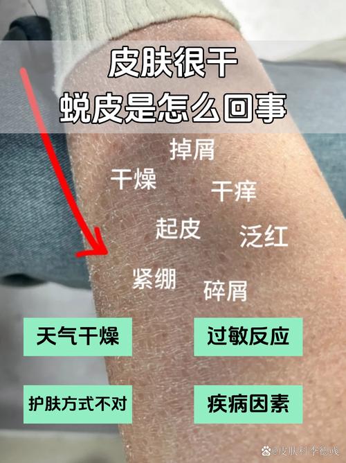 皮膚很乾是缺乏什麼
