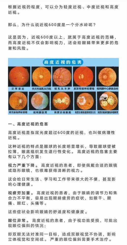 重度近視是幾度
