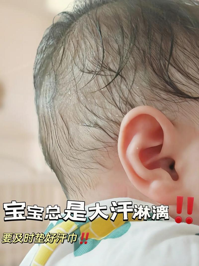 嬰兒睡覺流汗