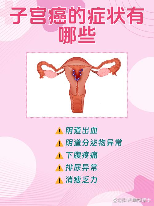 為何會得子宮內膜癌