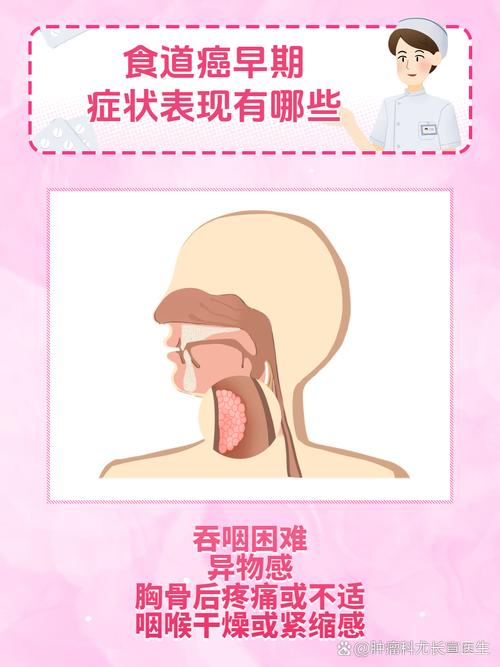 食道癌吞口水會痛嗎