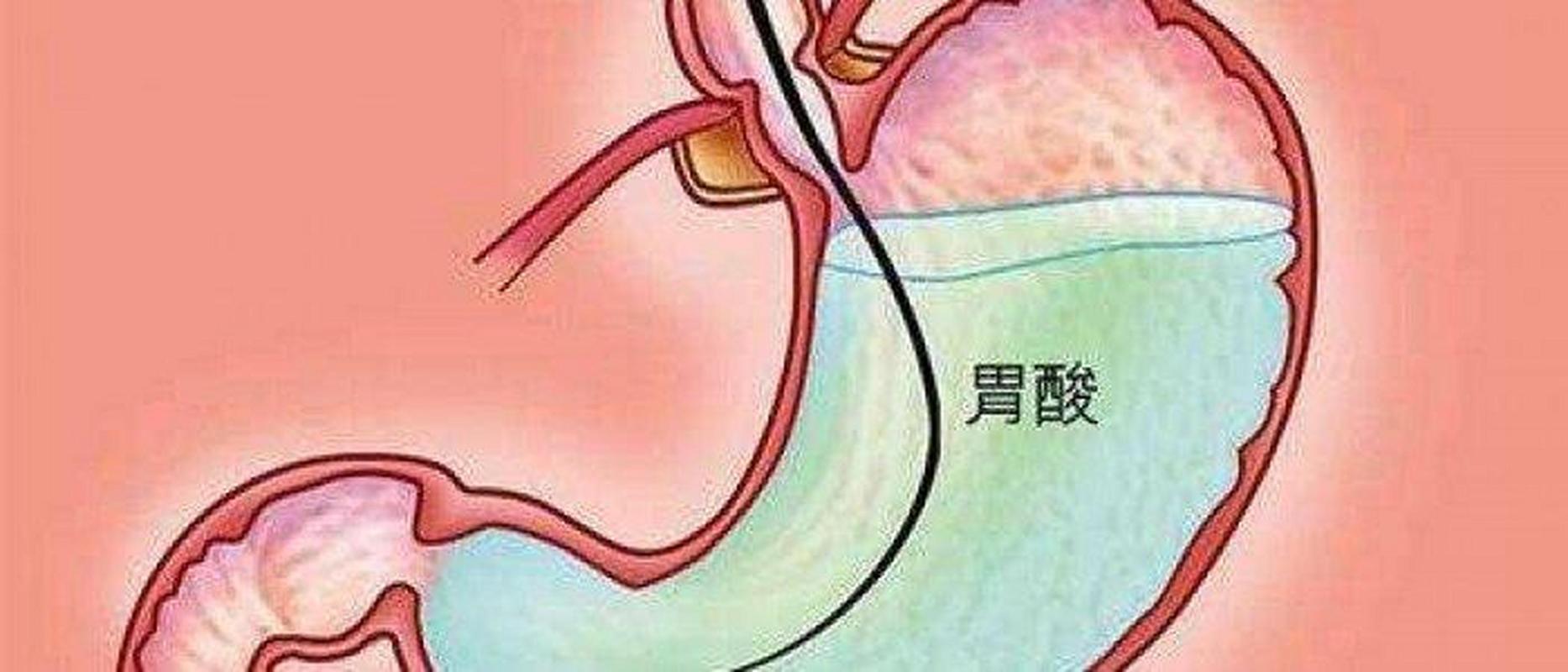 胃酸幾度