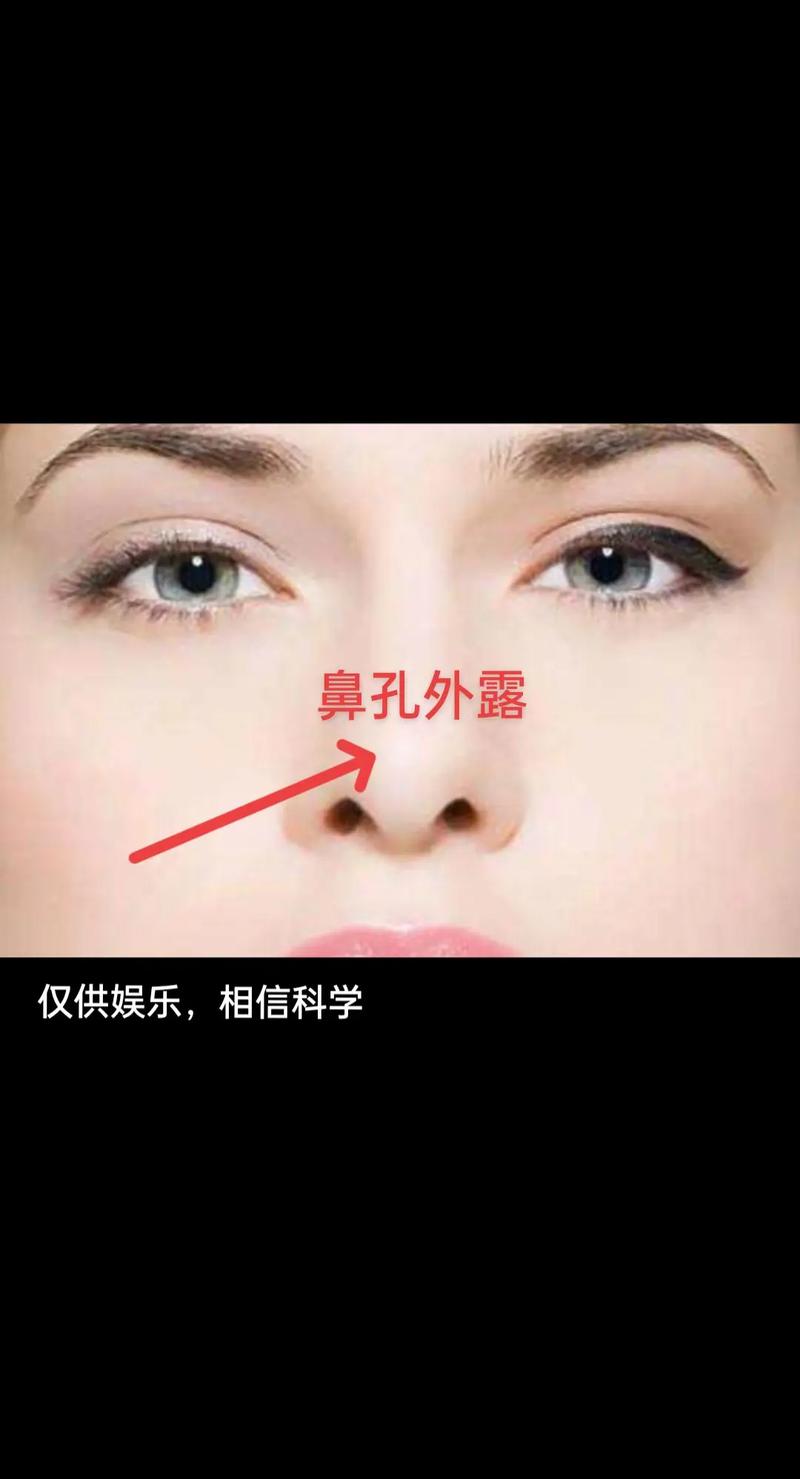 怎樣算鼻孔外露