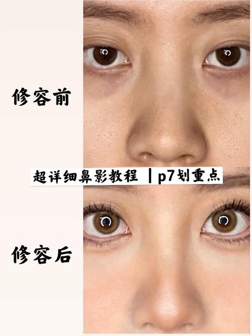 隆鼻要換護照嗎:整形手術後身份證明文件變更的完整指南與常見疑慮解析 1 隆鼻要換護照嗎