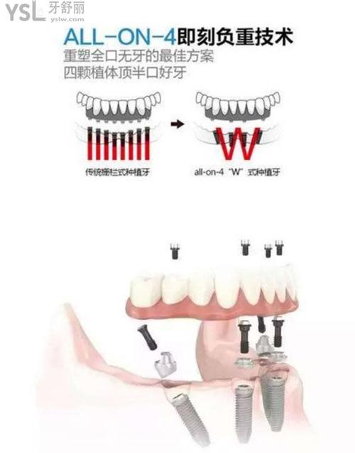 All on 4可以分期付款嗎