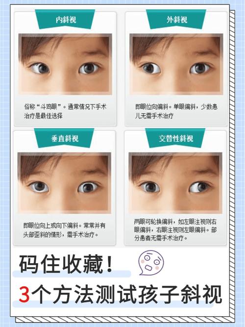 斜視會越來越嚴重嗎