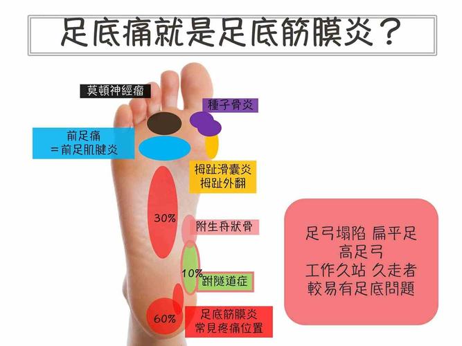 足底筋膜炎 貼布貼哪裡