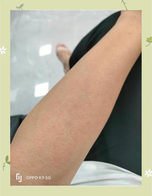 沒發現紫外線太強烈