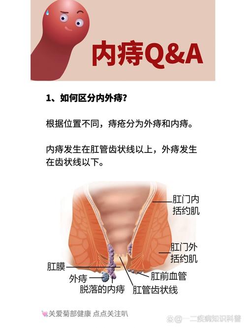 內痣會痛嗎