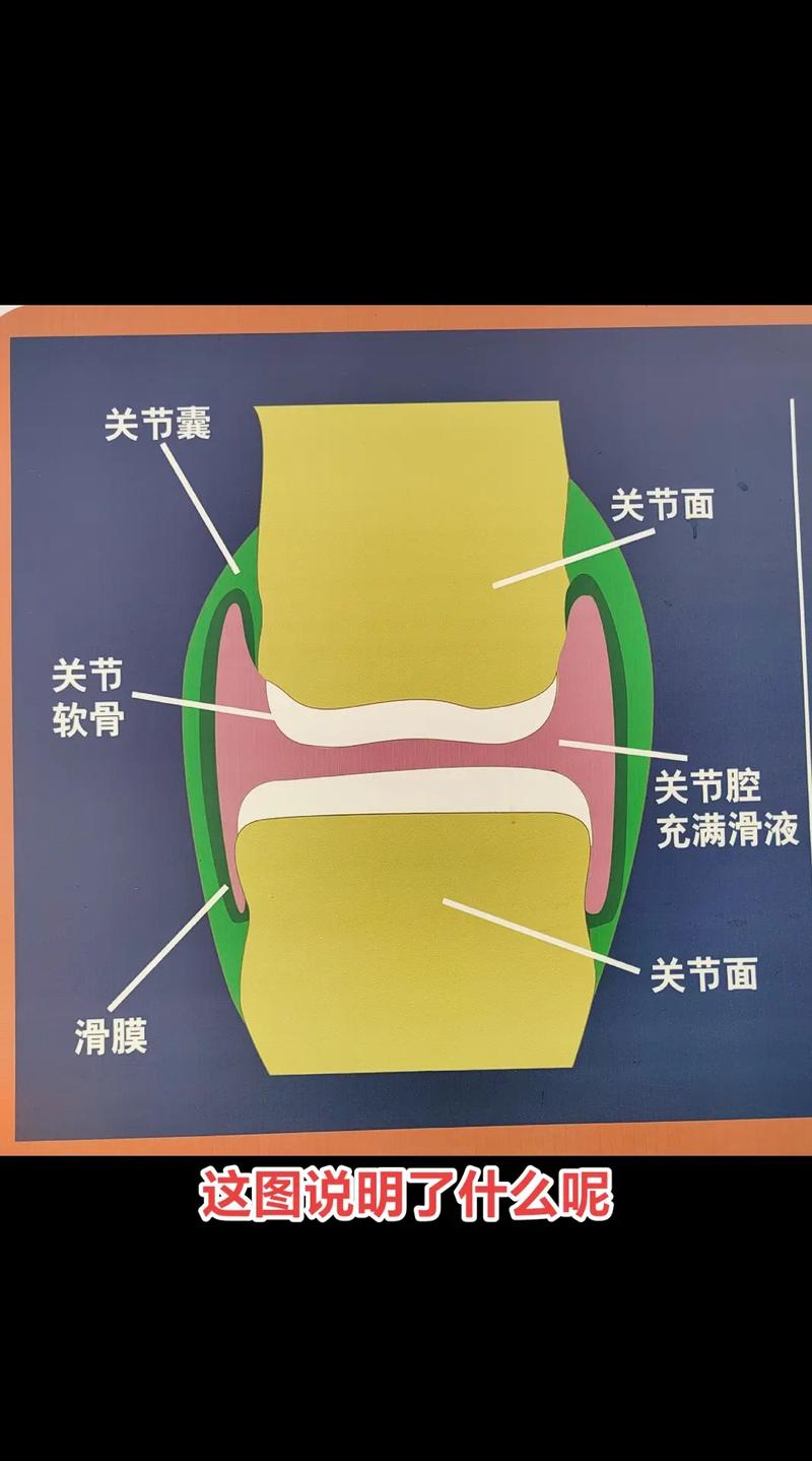 關節囊是什麼