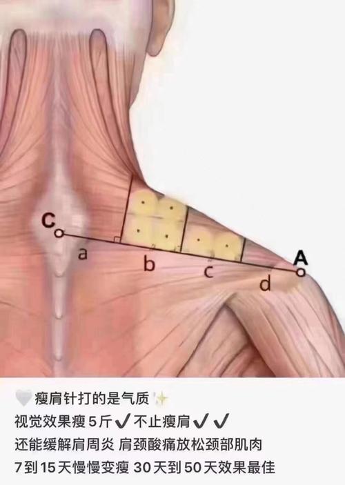 如何讓肩膀變軟