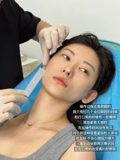 精靈針一定要打三次嗎