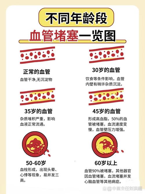 怎麼知道血管堵塞