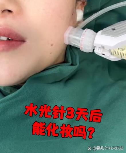 針孔多久癒合?深度解析傷口修復的奧秘與加速之道 3 針孔多久癒合