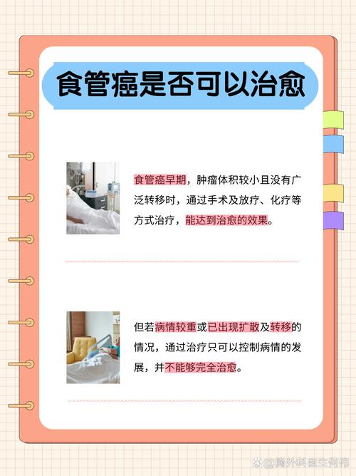 幾歲會得食道癌?解讀食道癌的年齡風險、成因與預防之道 1 幾歲會得食道癌