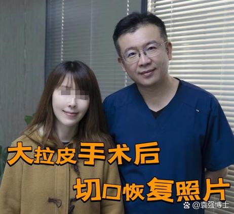 美皮豐怎麼貼?專業醫材師教你從零開始,無痛告別疤痕困擾! 3 美皮豐怎麼貼