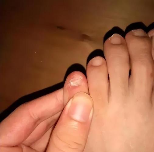 為什麼小拇指要留指甲:從文化習俗到實用功能,深度解析這項獨特習慣 1 為什麼小拇指要留指甲