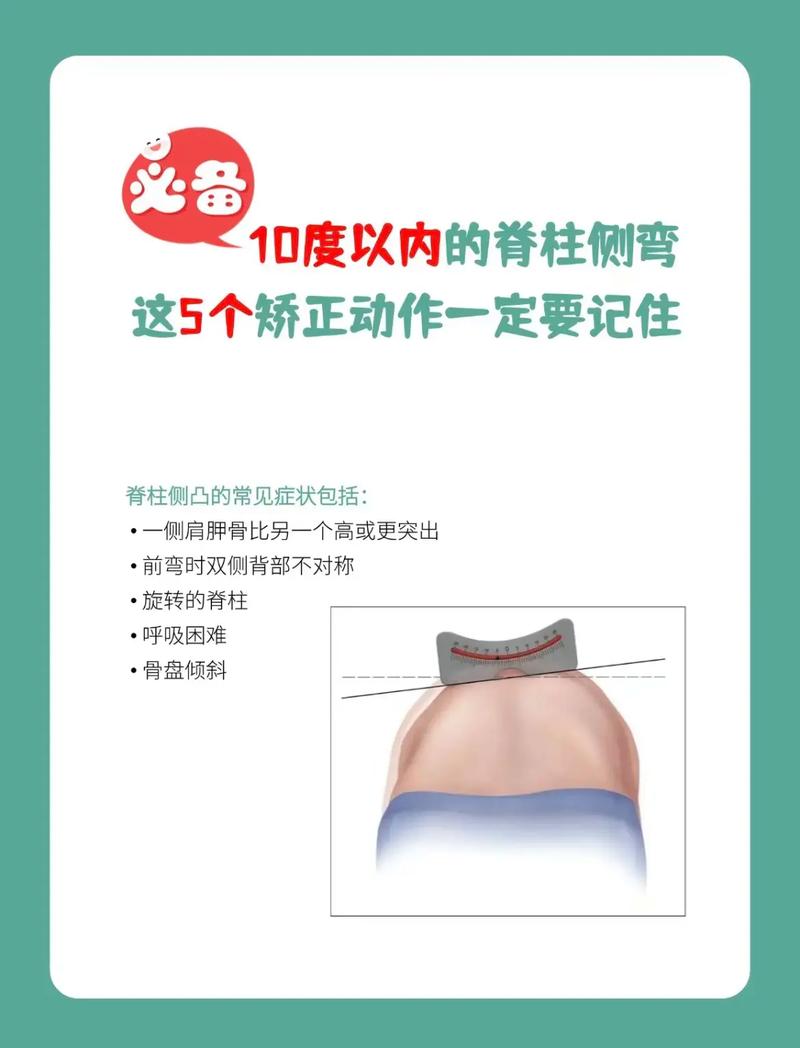 脊椎側彎可以倒立嗎