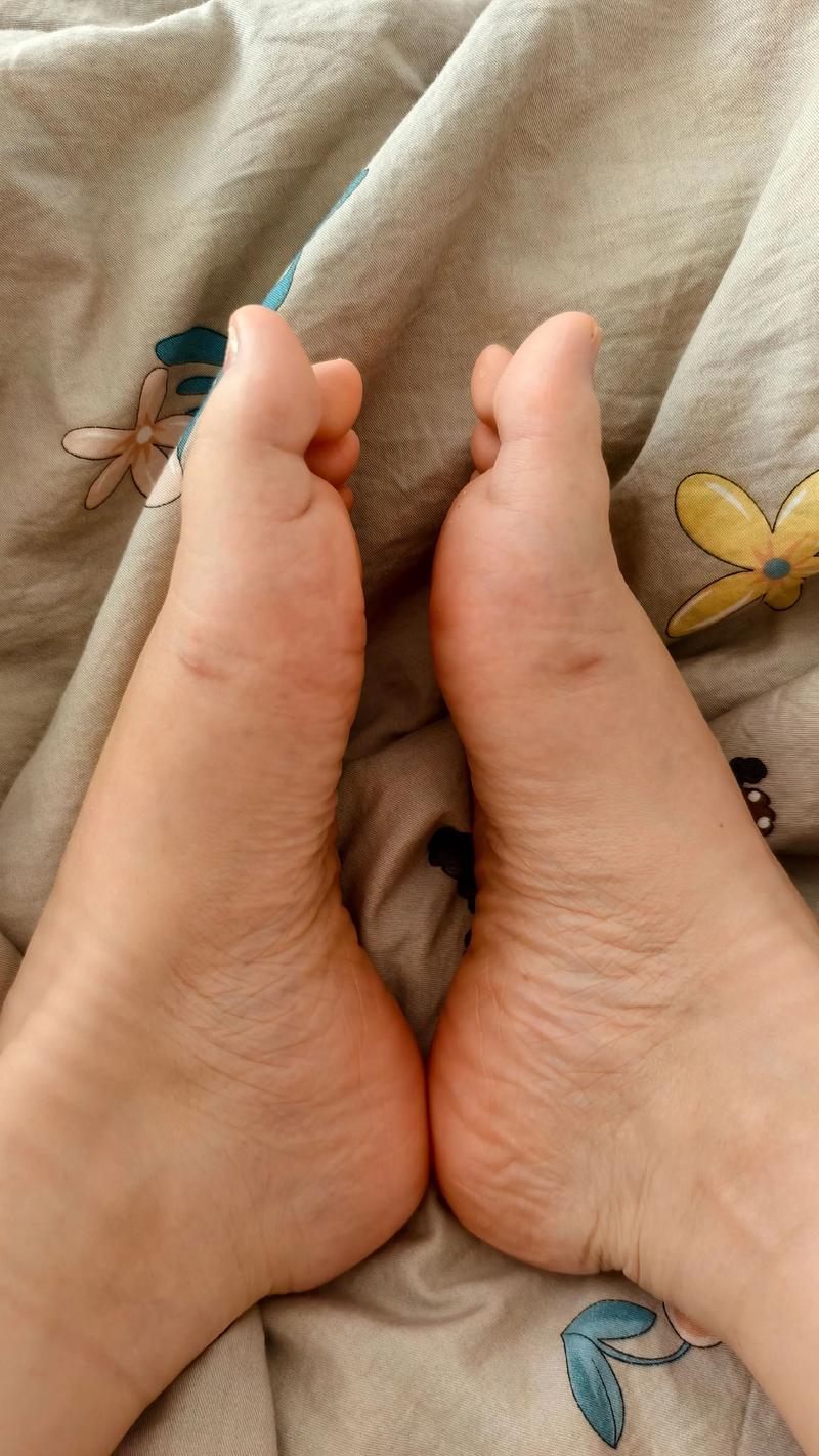 拇指外翻手術要休息多久