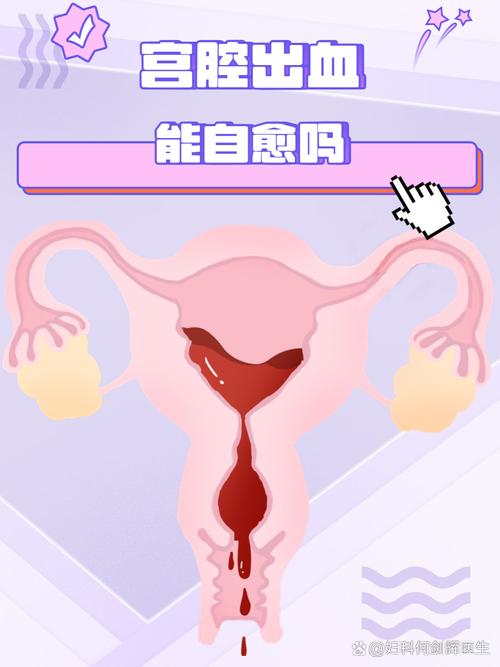 為什麼女生下面突然流血