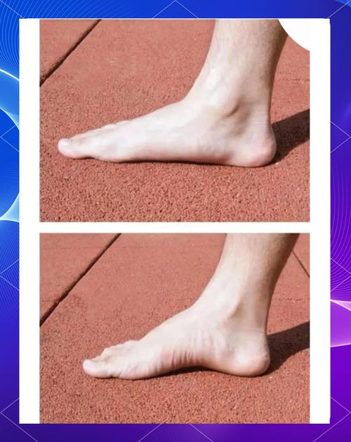 扁平足可以當軍人嗎