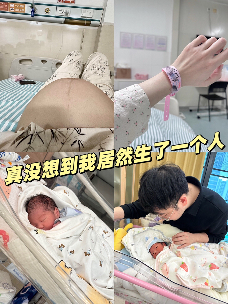 剖腹老公可以陪嗎