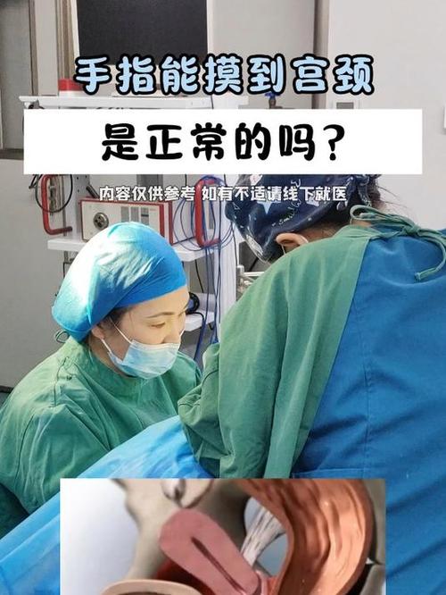 手指摸得到子宮頸嗎?深度解析自我觸診的奧秘與注意事項 3 手指摸得到子宮頸嗎