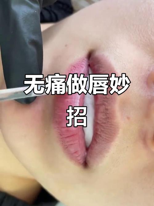 霧唇可以親親嗎