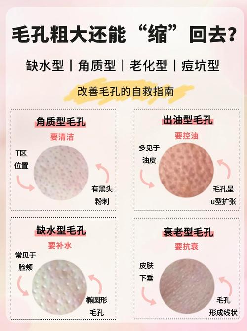 怎麼讓毛孔縮小