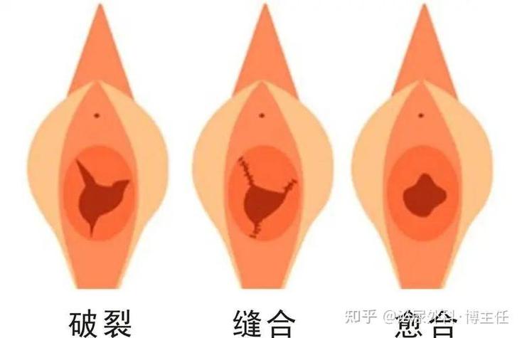 處女看的出來嗎