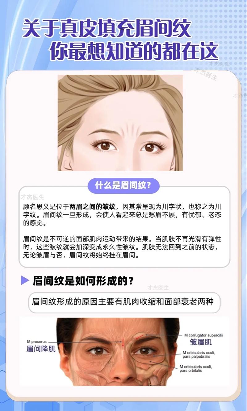 眉宇之間叫什麼