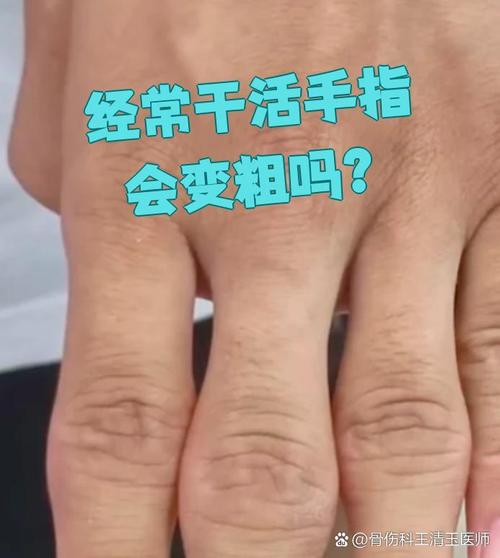 折手指會變粗嗎