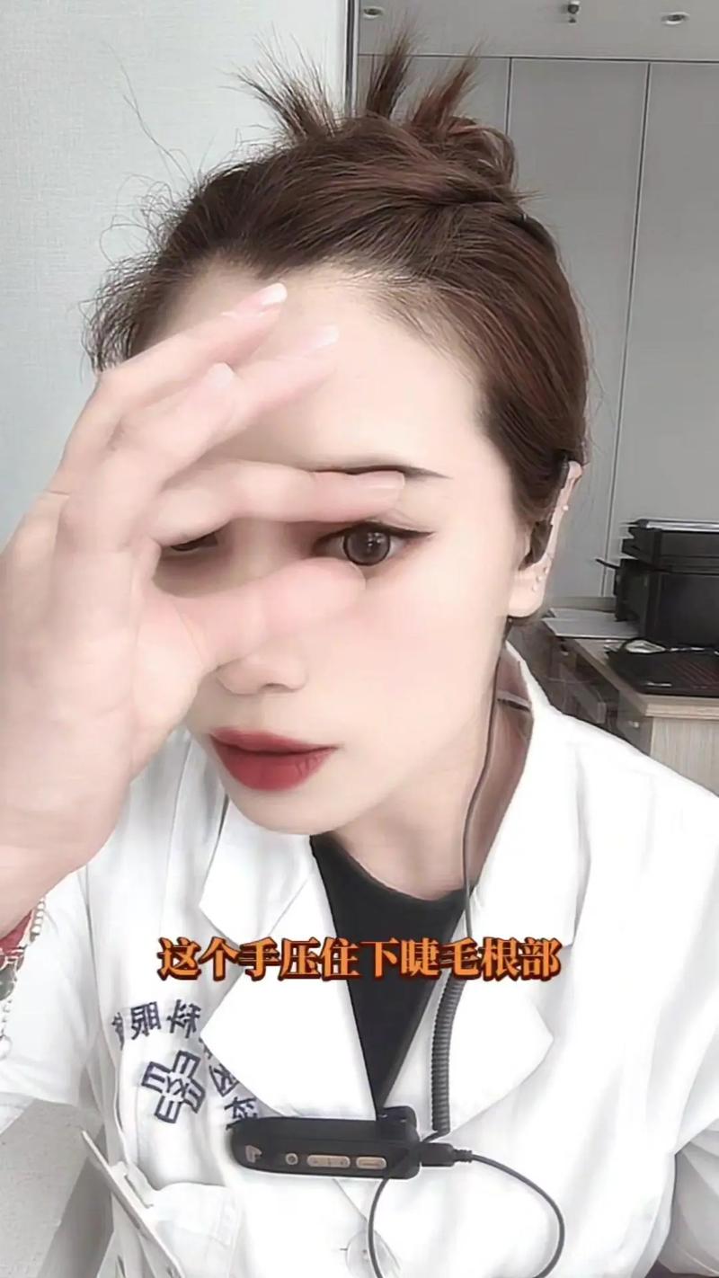 開眼頭多久可以戴隱形眼鏡?術後護理與恢復期的全方位指南 1 開眼頭多久可以戴隱形眼鏡