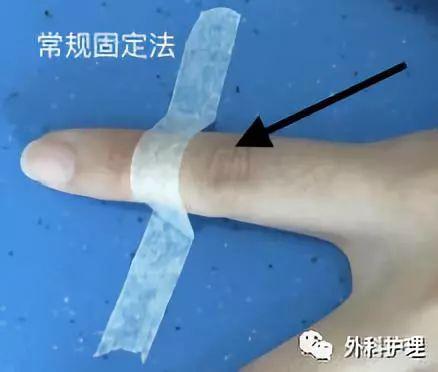 什麼是逕行舉發