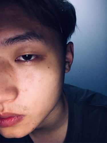 為什麼眼睛會無神