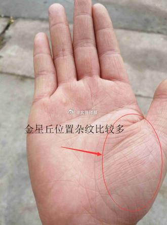 金星丘代表什麼