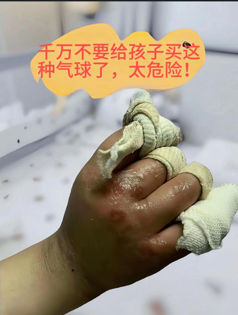 氫氣車會爆炸嗎