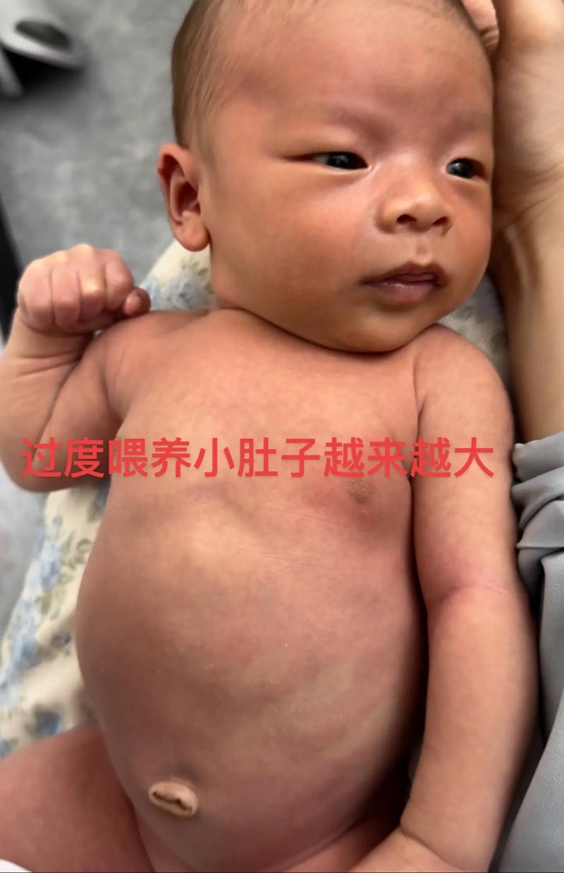 小孩肚子大正常嗎