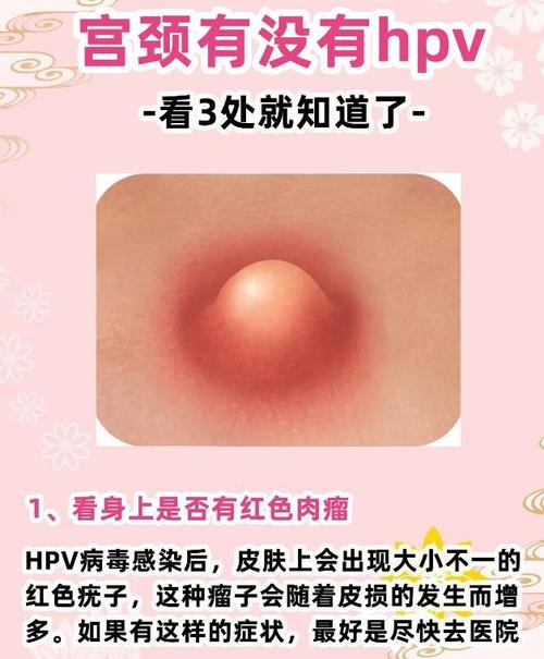 子宮頸癌 會臭嗎