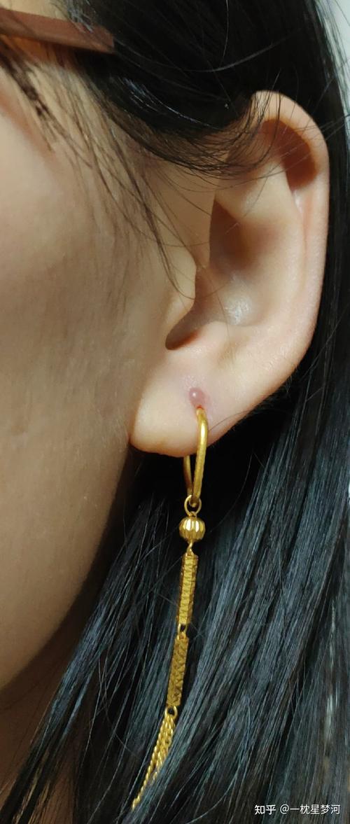 蟹足腫可以打耳洞嗎?深度解析蟹足腫體質的穿耳風險與安全指南 1 蟹足腫可以打耳洞嗎