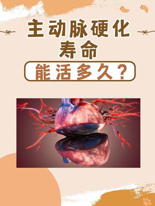 為什麼會動脈硬化