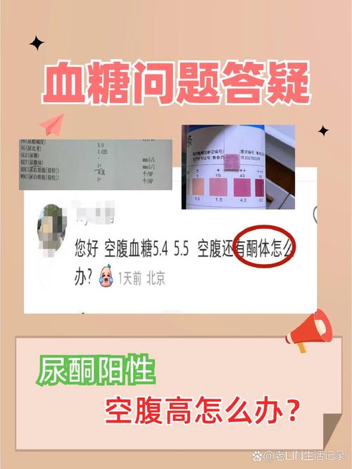 尿酮過高怎麼辦