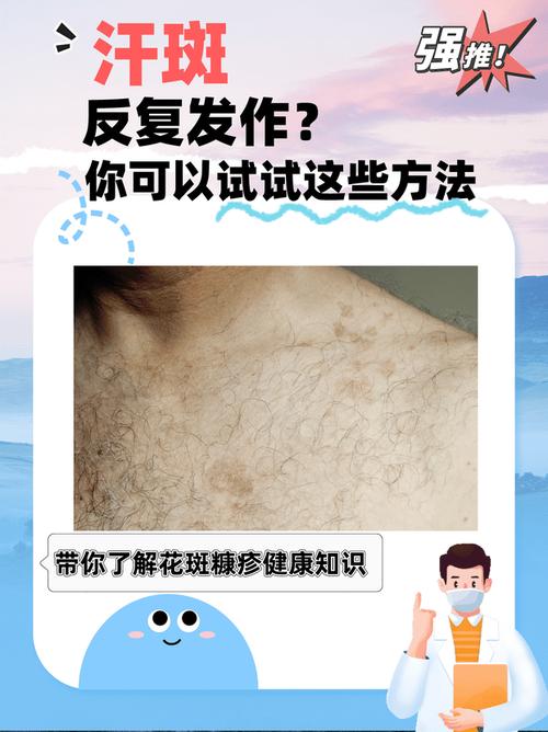 汗斑會消失嗎