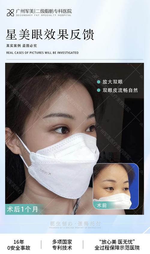 縫雙眼皮可以敷面膜嗎