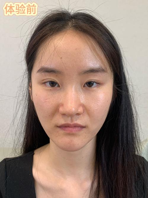 隆鼻諮詢可以化妝嗎