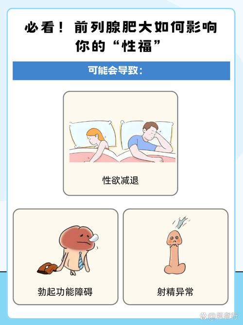 前列腺肥大如何改善