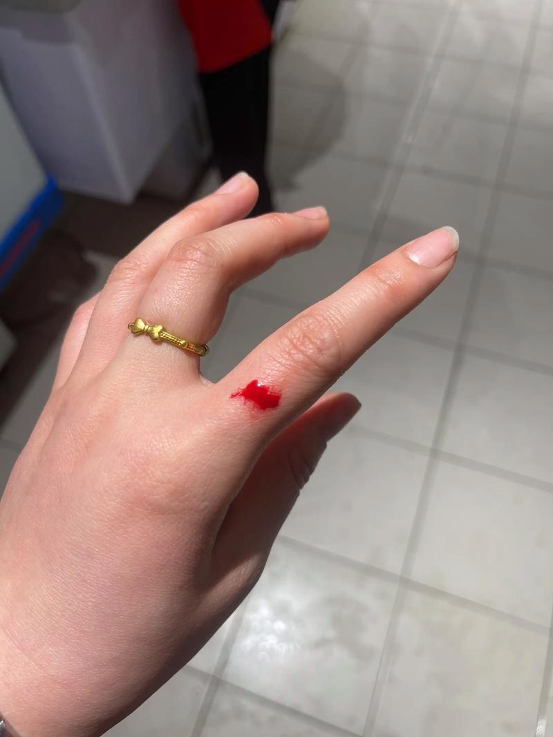 碰到別人的血會怎樣嗎