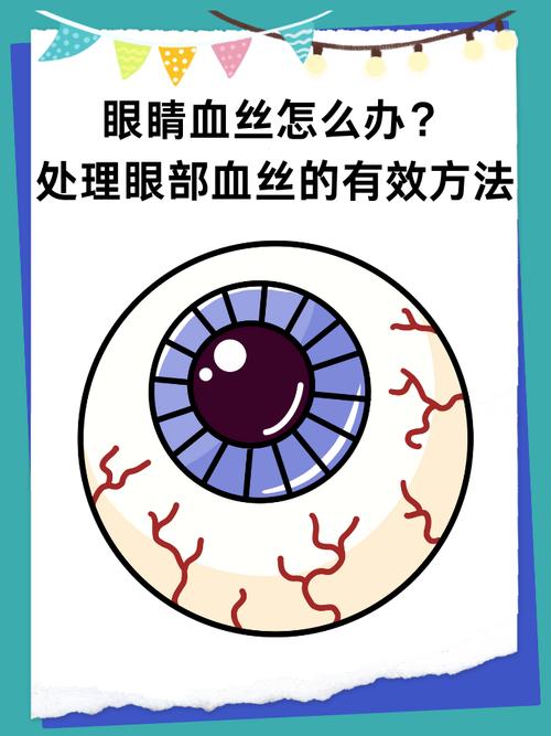 眼睛為什麼突然有血絲