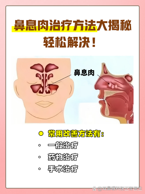 為什麼鼻子會長瘜肉